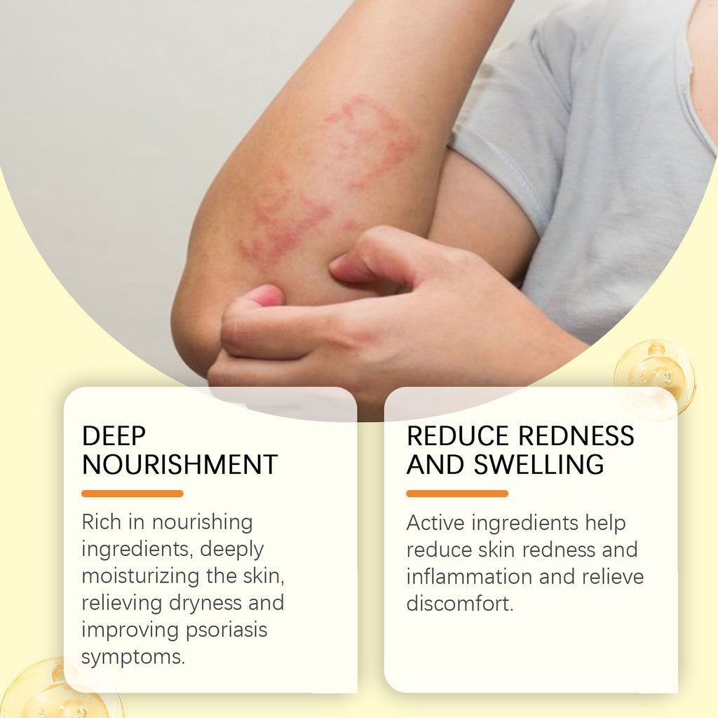 Skin Repair Cream, Skin Repair Cream For The Body And Hands And Feet