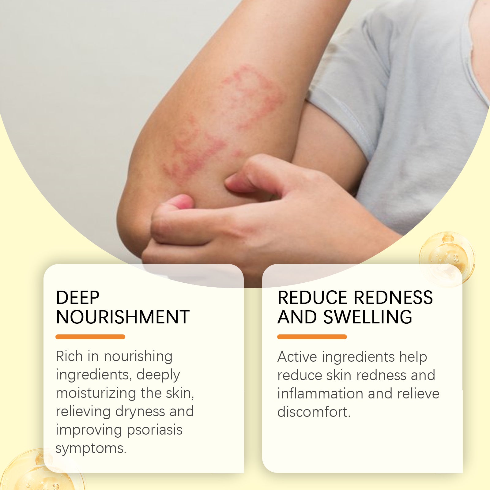 Skin Repair Cream, Skin Repair Cream For The Body And Hands And Feet