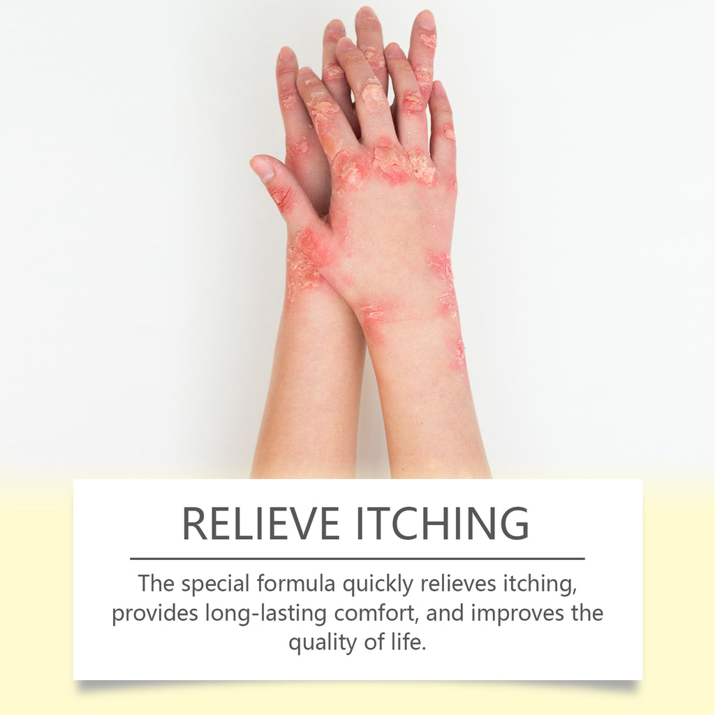 Skin Repair Cream, Skin Repair Cream For The Body And Hands And Feet