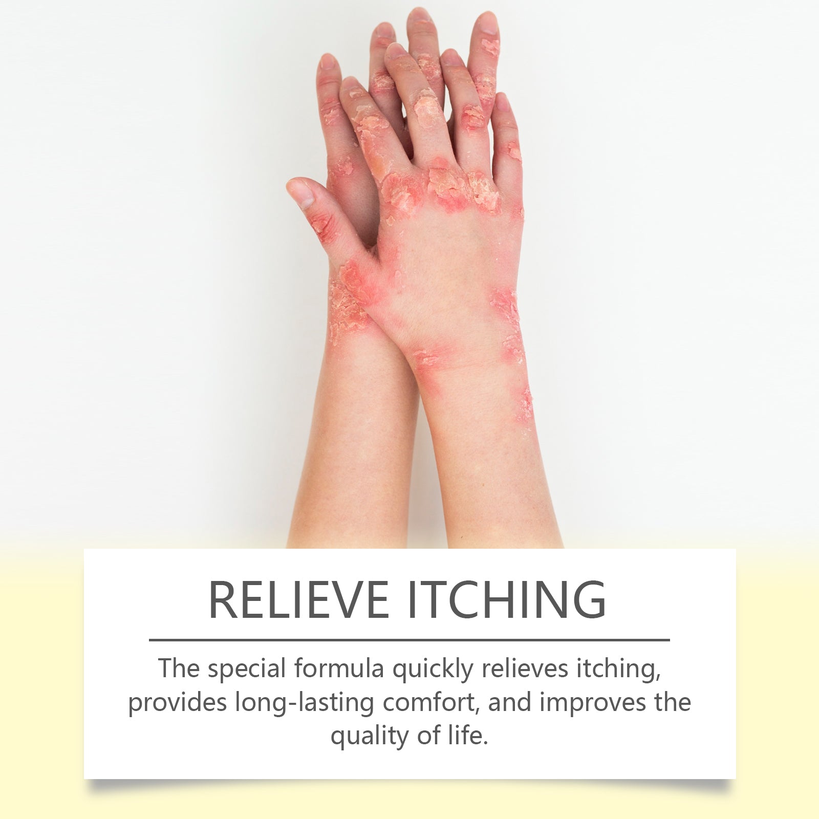 Skin Repair Cream, Skin Repair Cream For The Body And Hands And Feet