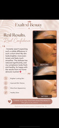 Exalted Beauty Alpha Arbutin Kit — brightening and radiance system