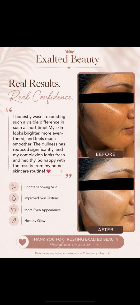 Exalted Beauty Alpha Arbutin Kit — brightening and radiance system