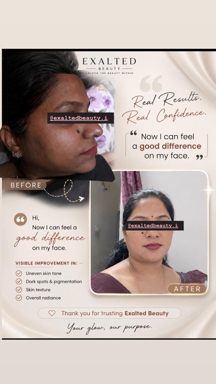 Exalted Beauty Alpha Arbutin Kit packaging