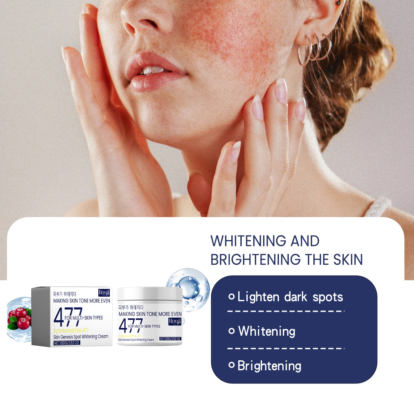 Skin Genesis Spot Whitening Cream, Dilute Spots Smooth Skin Bright White Color This Delicate Skin Moisturizing Cream