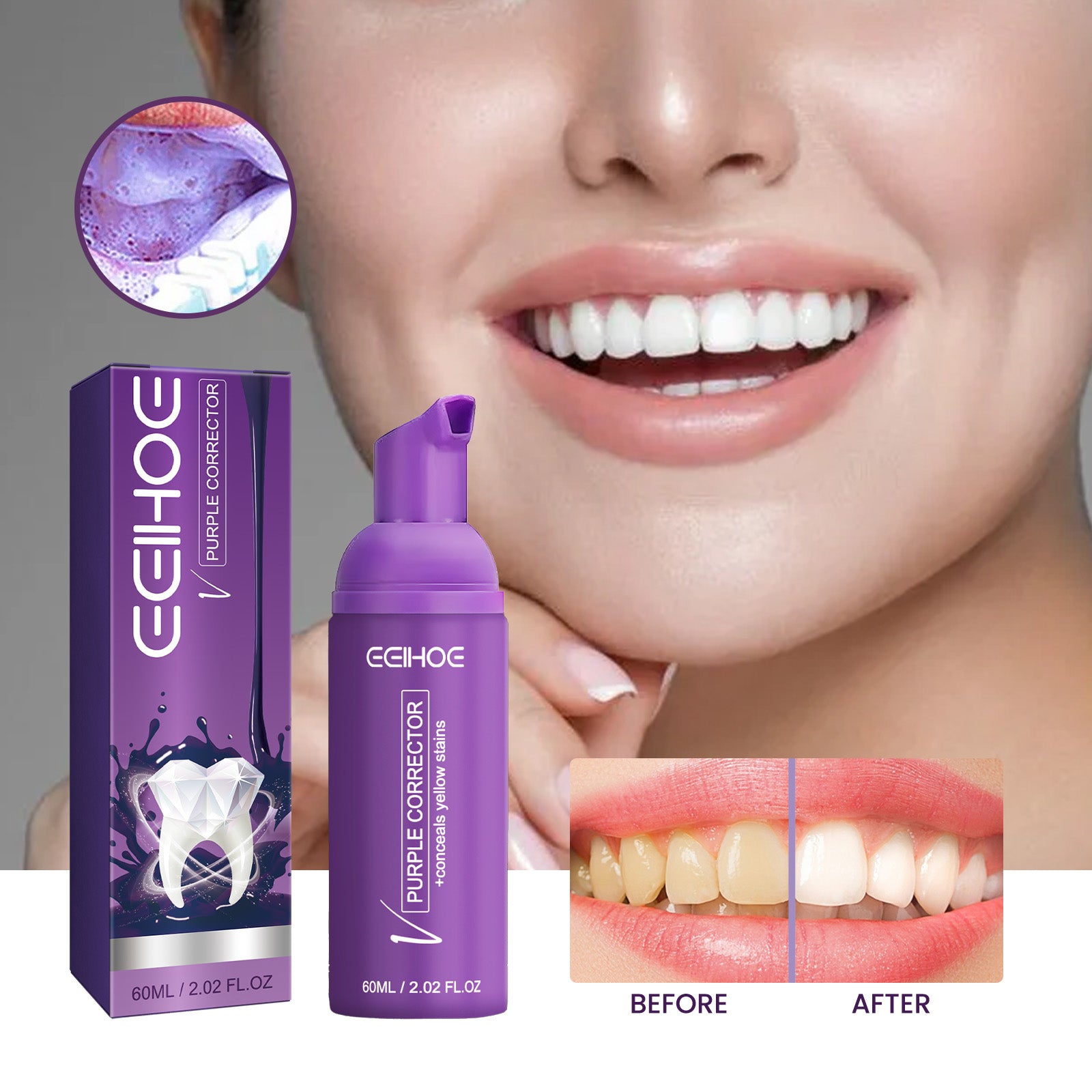 Purple Corrector, Deeply Clean Tartar Very Well Tartar Yellow Teeth Care For Oral Health Care